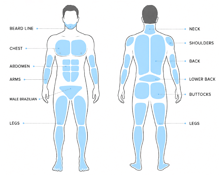 Men's laser hair removal treatment areas including chest, abdomen, back, shoulders, legs, beard line and male Brazilian area.