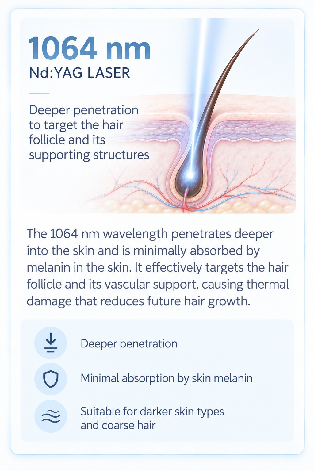 Educational diagram showing how the Nd:YAG laser works for laser hair removal on dark skin tones