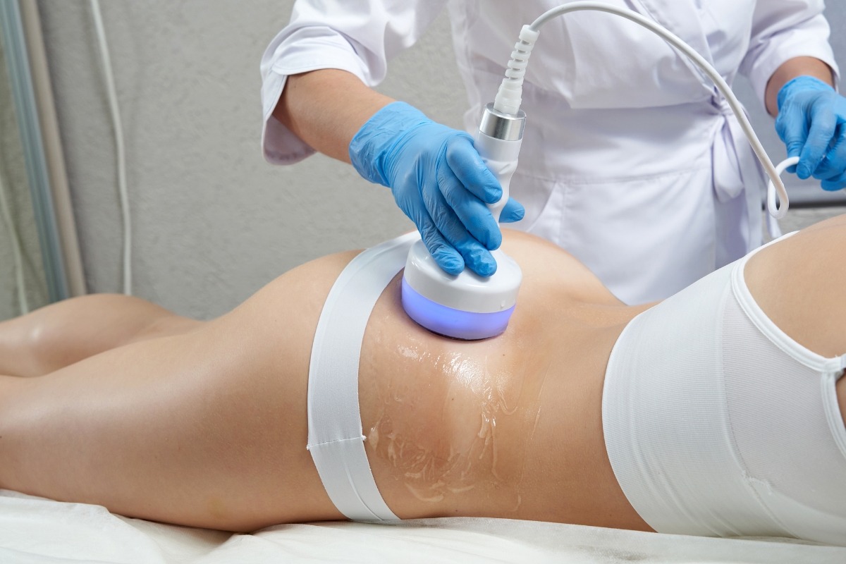 Non-invasive body contouring treatment at Prima Britannia Laser Clinic in Hammersmith London
