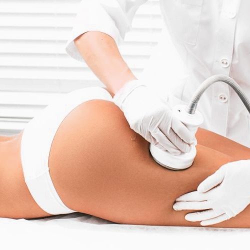 Cavitation Inch Loss Treatment in Hammersmith London is the most effective solution for cellulite and fat reduction.